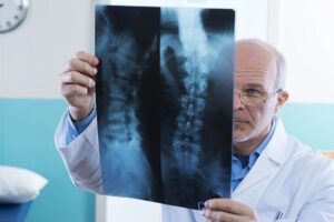 A doctor is holding an x-ray and examining